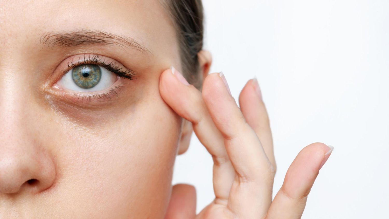 Mesotherapie Augenringe