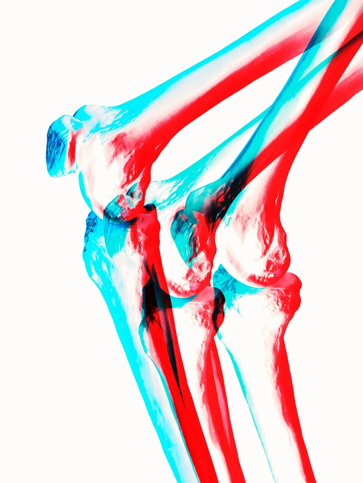 Sports injuries - just a bit of kicking