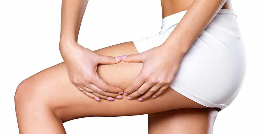 Coolsculpting: innovative Kältetherapie gegen Fettpölsterchen