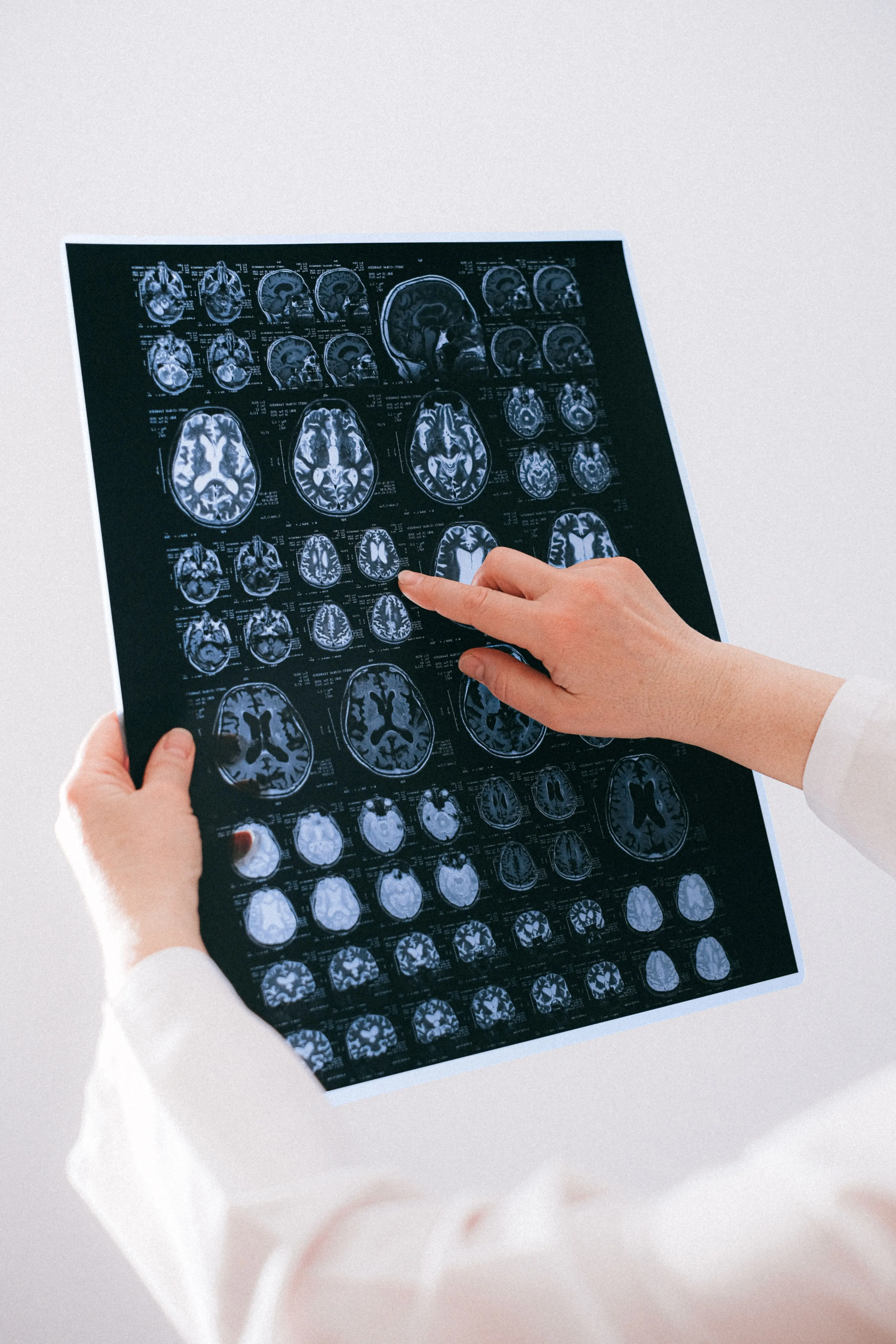 Scan von menschlichen Gehirnen Demenz