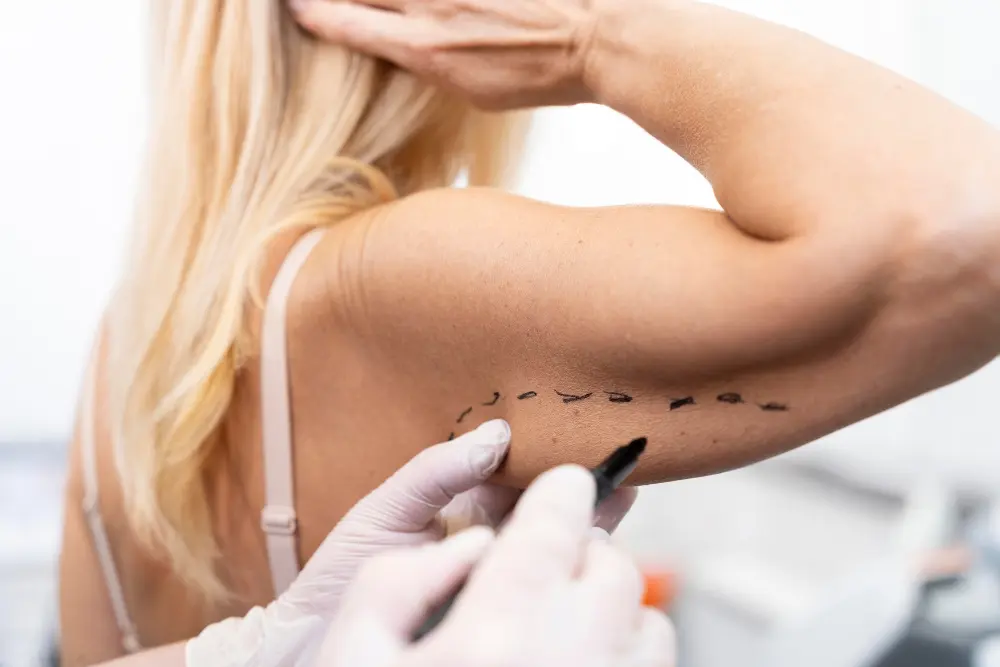 plastische Chirurgie Arm Haut nach Ozempic