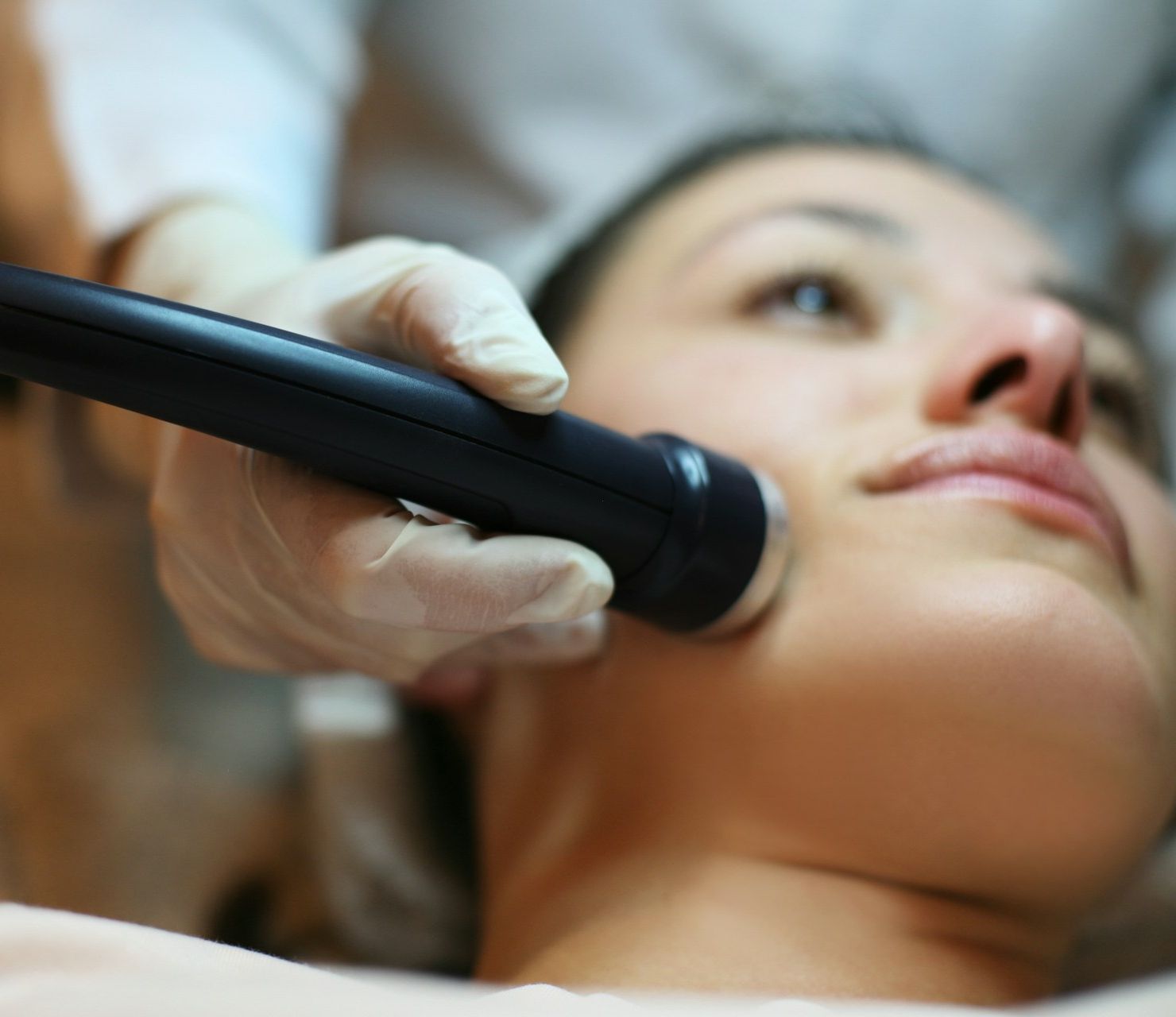 Hautstraffung ohne Facelift Laser Xerf
